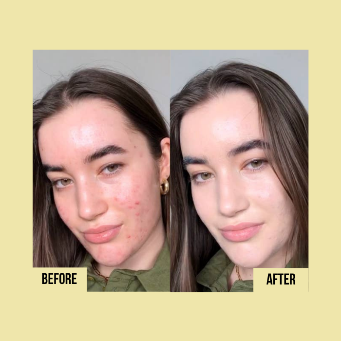 Medicube | Vitamin C Capsule Cream