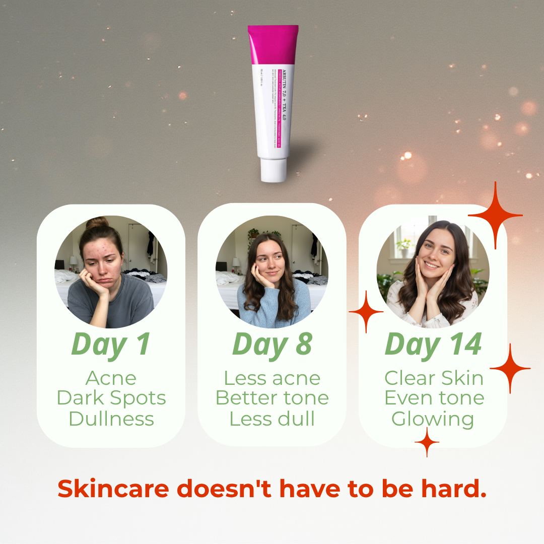 Arbutin 7% + Tranexamic Acid 4% Cream