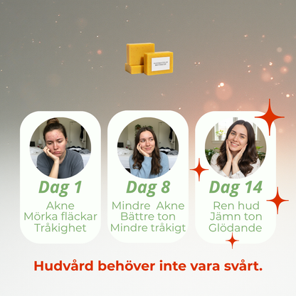 Tvål med gurkmeja, citron och kojinsyra