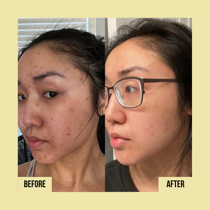 Medicube | Vitamin C Capsule Cream