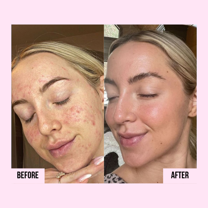 Medicube | PDRN Capsule Cream