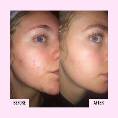 Medicube | PDRN Capsule Cream