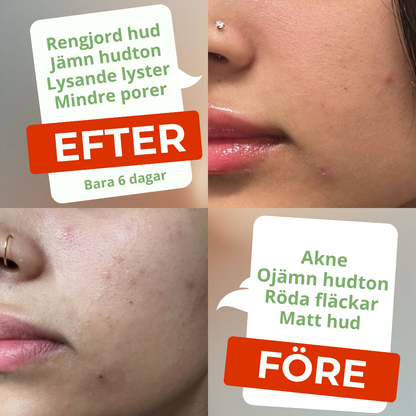 Anua | Den Ultimata Hudvårdsrutinen