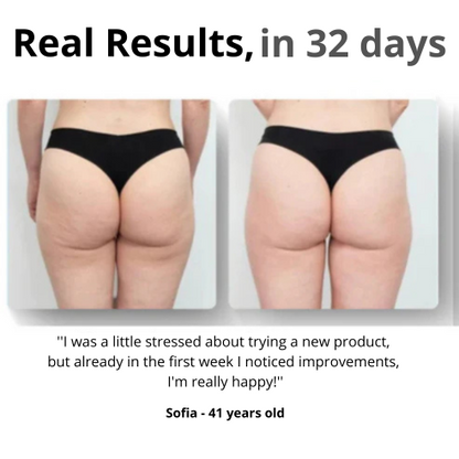 K-BEAUTY Cellulite Massager