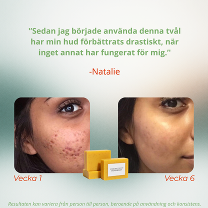 Tvål med gurkmeja, citron och kojinsyra